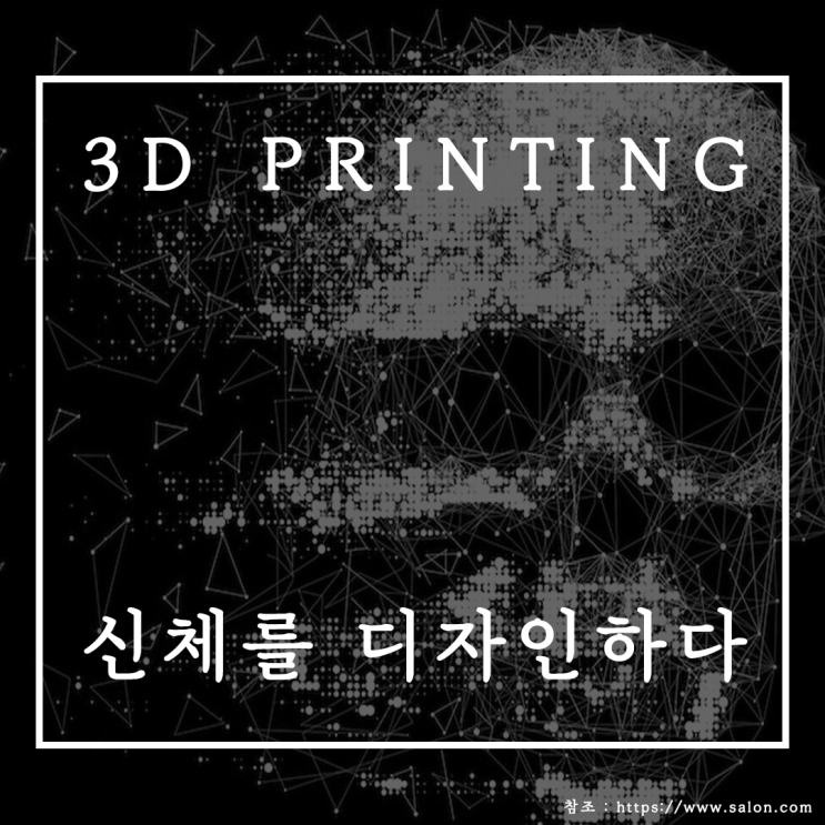 3d프린터 수술, 3d프린터 뼈, 3d 프린터 화성 !!