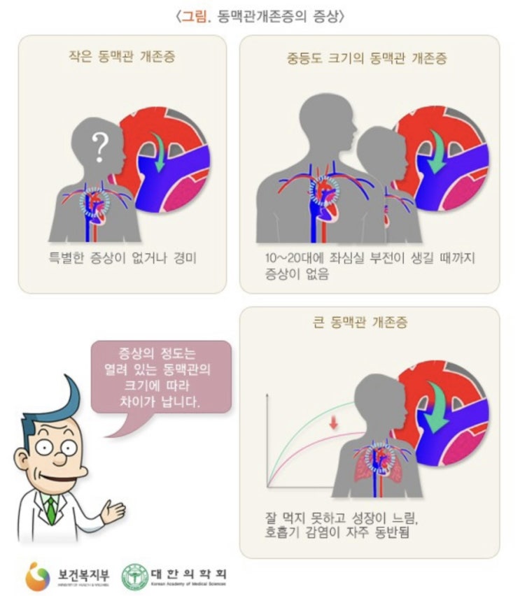 동맥관개존증이 뭘까? 24개월 이지한 드디어 동맥관개존 자연폐쇄!! c 동맥관개존증이 뭘까? 24개월 이지한 드디어 동맥관개존 자연폐쇄!! c