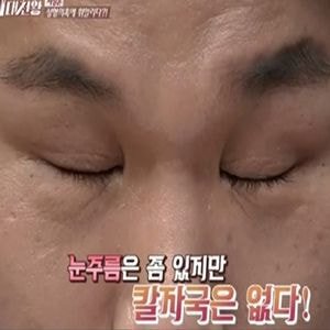  은근있다는 나이들어 생기는 쌍커풀 서장훈