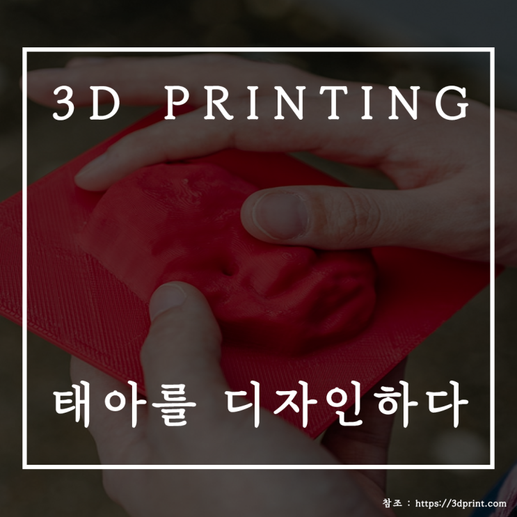 3D 프린터 태아피규어 , 3D 프린터의 활용!