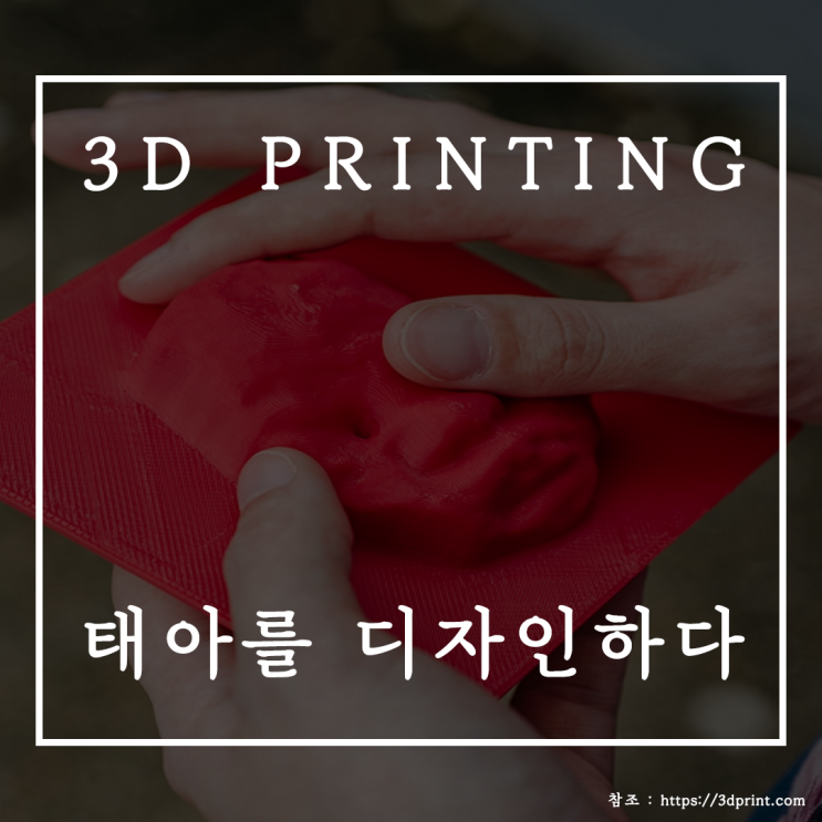  3D 프린터 태아피규어 , 3D 프린터의 활용!