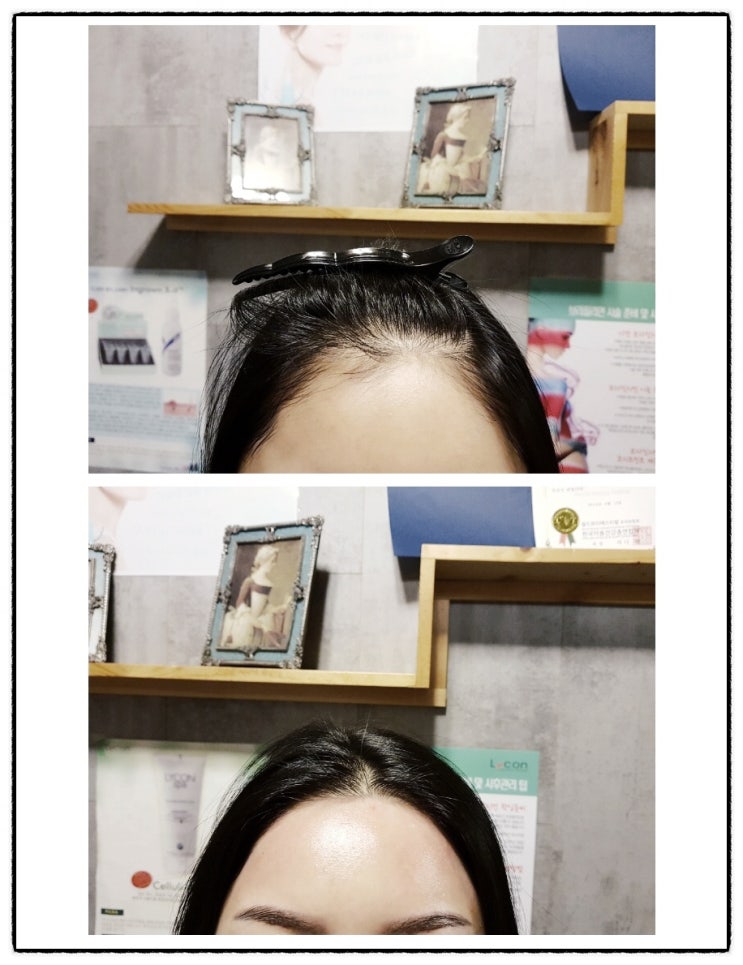 창원왁싱 상남동 브라질리언 왁싱 여우발자국 왁싱Q