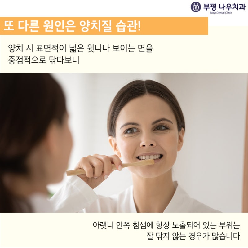 아랫니 치석이 잘 생기는 이유는? 4