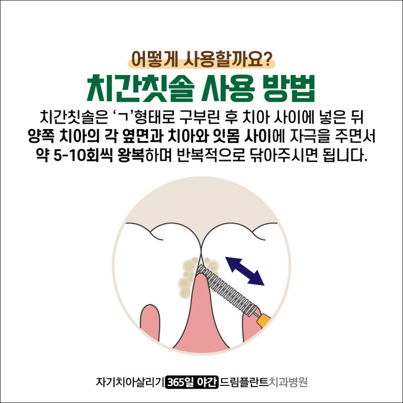 자신의 치간칫솔 사이즈를 알아보고 사용해보세요! 8