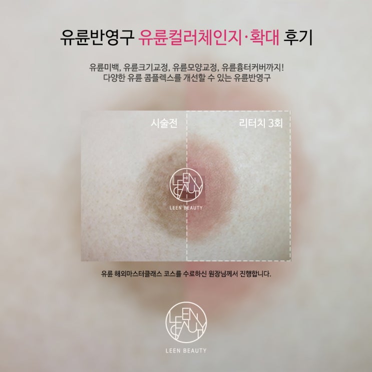  유두 유륜 반영구 크기 모양 흉터커버 모두 가능한 삐땅기린뷰티