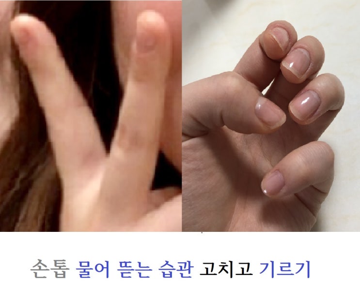  손톱 뜯는 습관 없애고 바디 기르기 :: 손톱 예뻐지기 by엘리씨