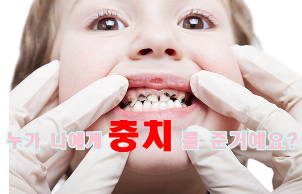  당감동치과 영유아검진 아이충치 왜 생길까?