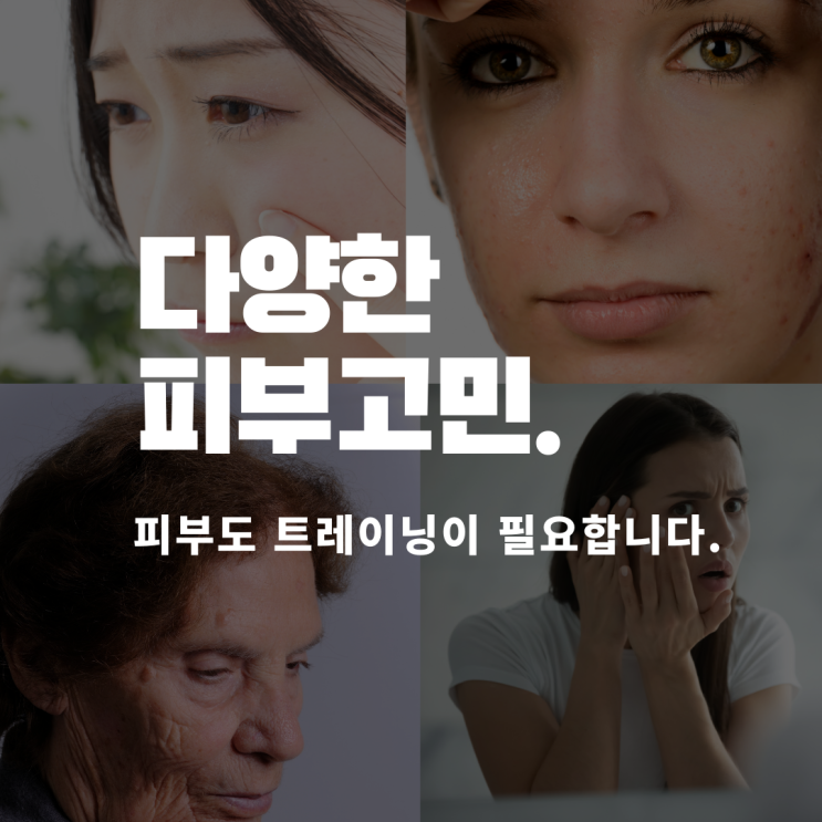  피부 자생력 끝판왕 본연의 힘을 기르자 세멘시트로
