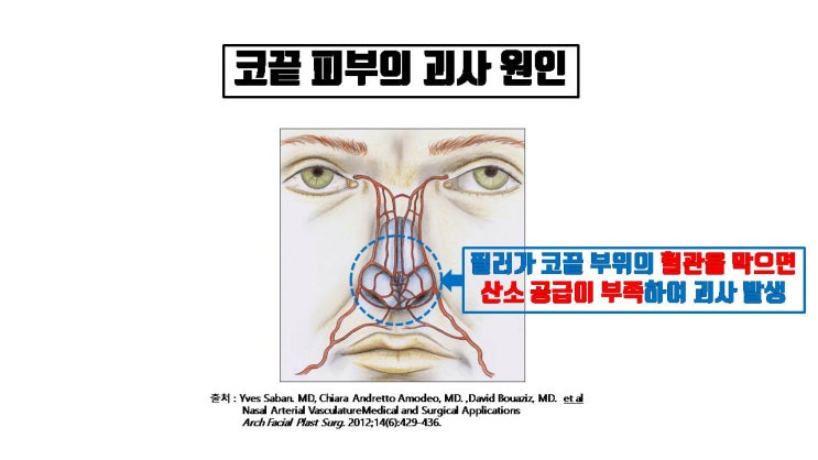  코수술이나 코필러 후 발생하는 피부 괴사, 빨리 조치하지 않으면 후유증이 심해요