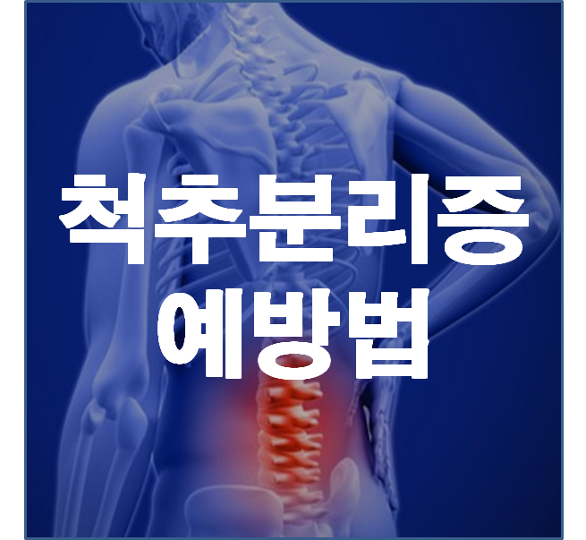  척추분리증 군대 면제인가요? 척추분리증 질환에 대해 알아봅시다.