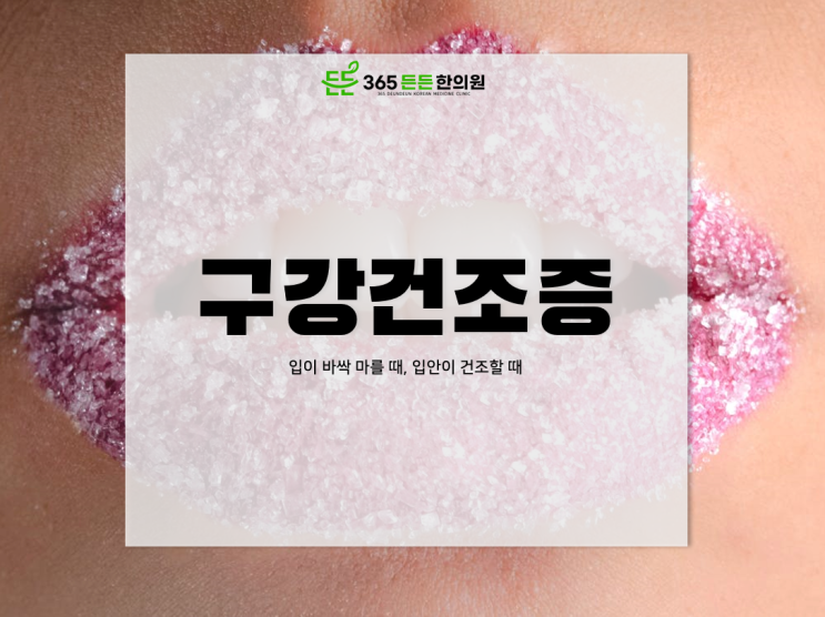  입이 바짝 말라요. 입 마름 어떻게 치료할까요?