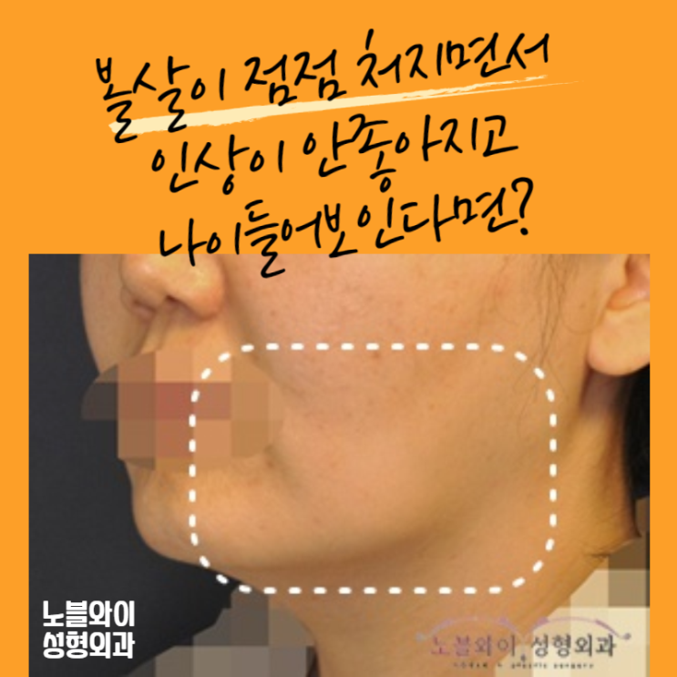  처진볼살리프팅 어려보인다는말 듣고 싶다면