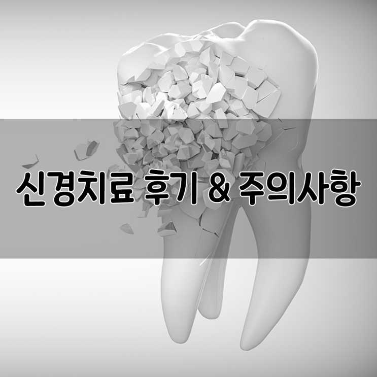  신경치료 후기 :: 주의사항