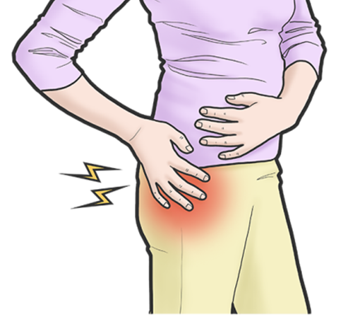 고관절 통증, 엉덩이 통증, 고관절 대전자 점액낭염 - 일산 한의원 - 가로세로한의원 일산점