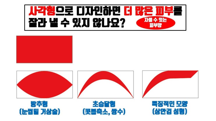 성형외과 전문의가 콧볼축소, 절개 쌍꺼풀, 눈썹거상술 시 제거해 내는 피부 모양은 모두 비슷해요.