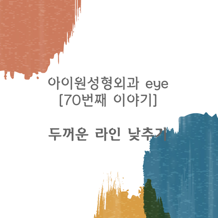  [아이원성형외과 eye] 눈매교정 없이 두꺼운 쌍꺼풀 라인을 낮추고 싶어요