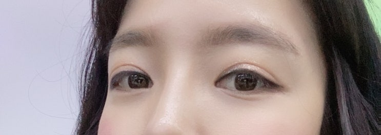  문신제거/아이라인문신제거/아이라인제거/내돈내산/찐후기