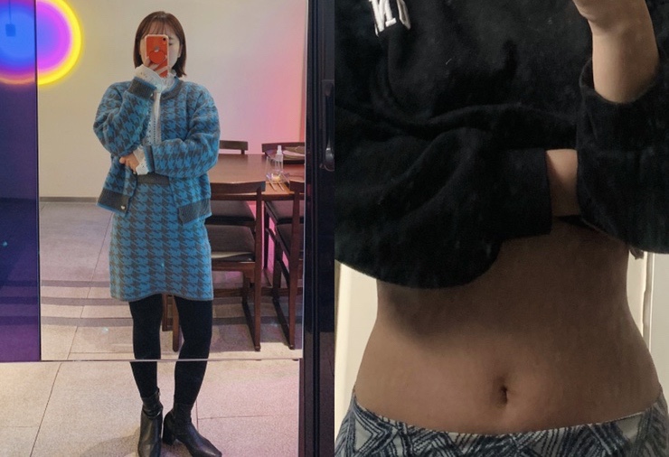  유산균다이어트 뱃살빼기 성공!