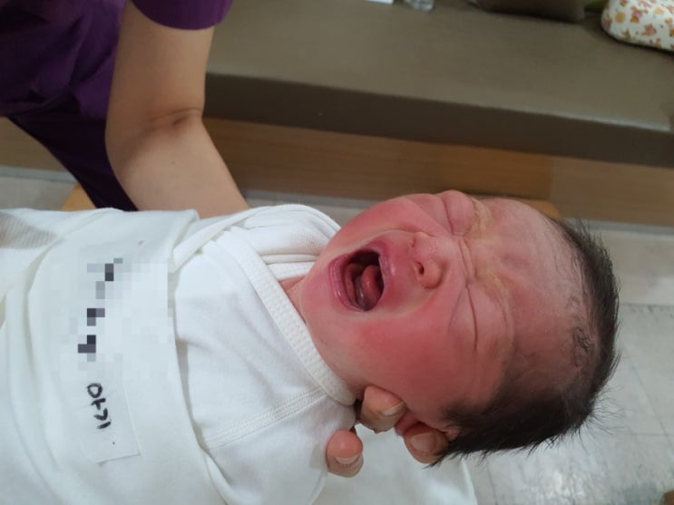  용인제일산부인과 제왕절개술 3일차 후기