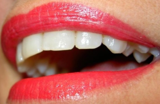황니는 치아미백 중에서 스탠다드 프로그램으로 치과 치료를 받으시는게 좋습니다.