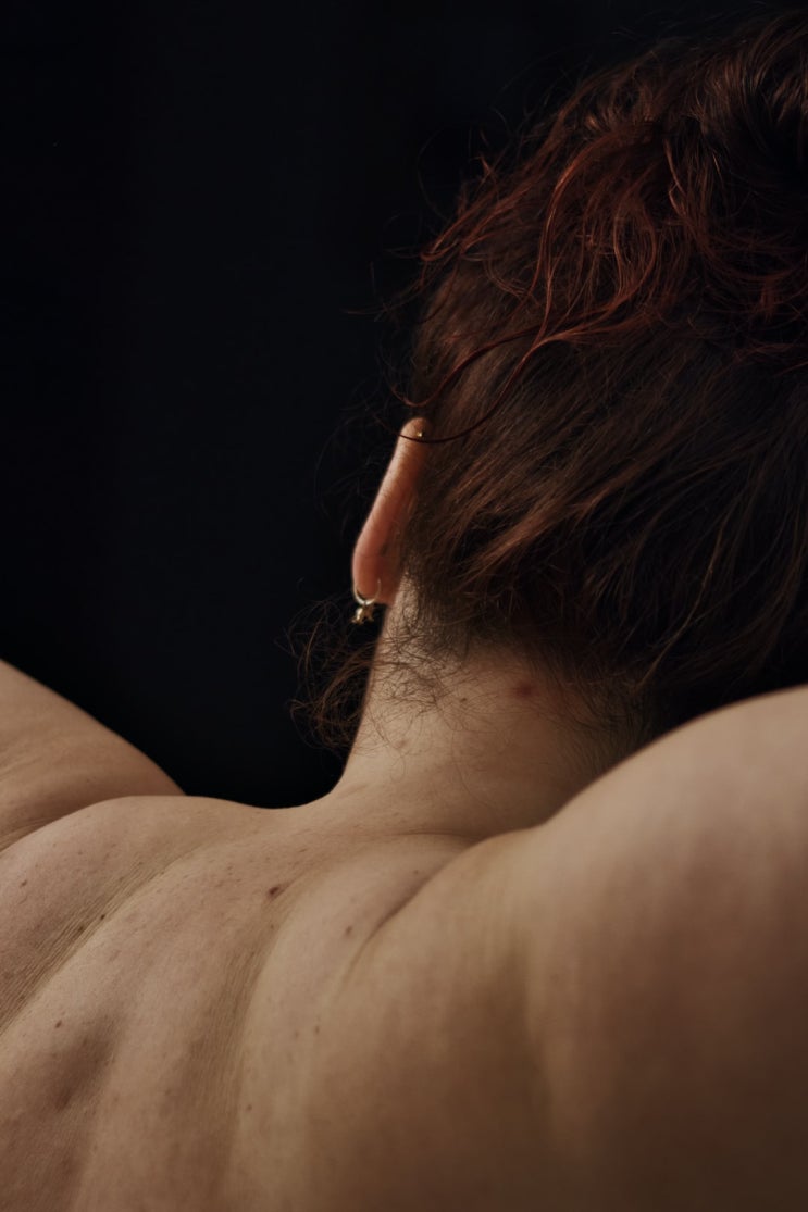  견관절 와순파열 증상 종결후 수년간 더 치료시 산재보험은 면책, 근재보험은 부책인지 여부