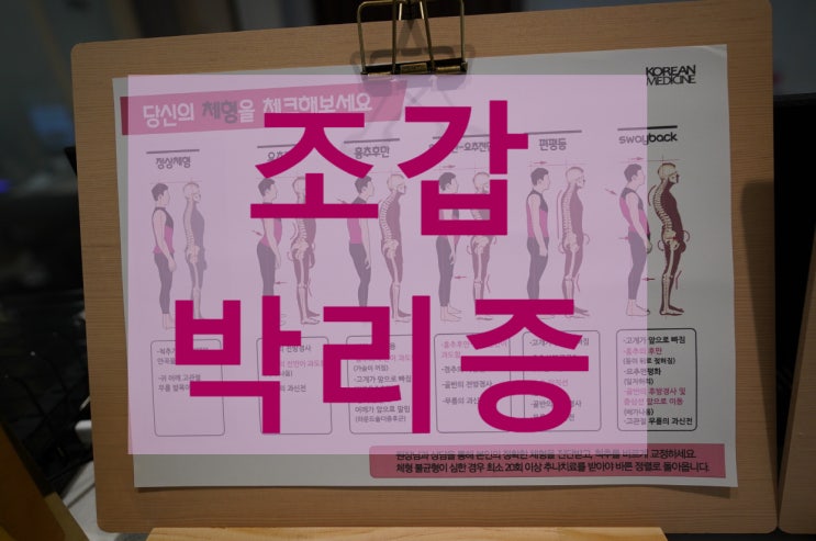  광명조갑박리증 손톱과 발톱이 떨어져 나갈 수 있어요