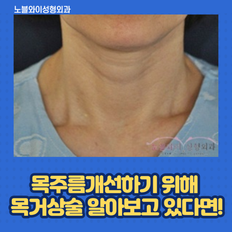  목거상술비용 매끈한목라인보니 안아깝다