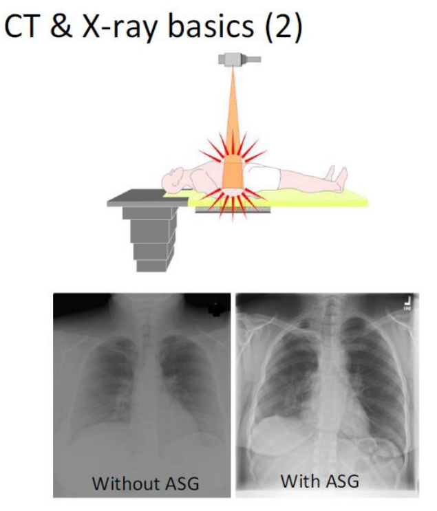 X-Ray, CT 의 Anti-Scatter Grid를 텅스턴으로 제작하는 금속 3D프린터 : 네이버 블로그