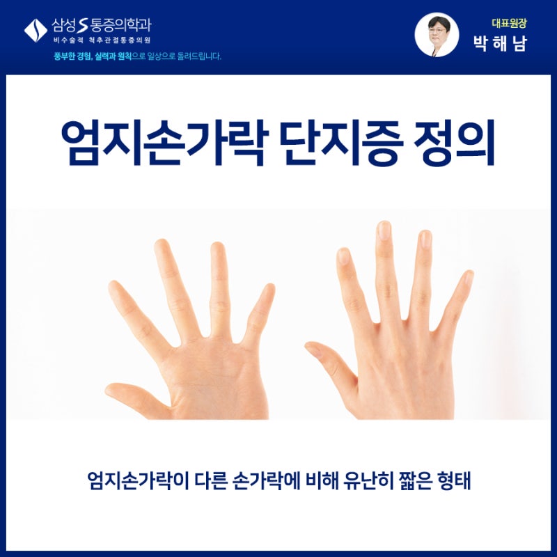 엄지손가락 단지증 남들보다 손가락이 짧거나 길다면 : 네이버 블로그