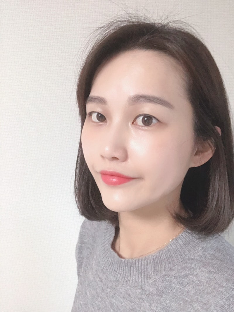 압구정 이마필러 잘하는곳 다이나믹 리얼 후기(통증,붓기) : 네이버 블로그