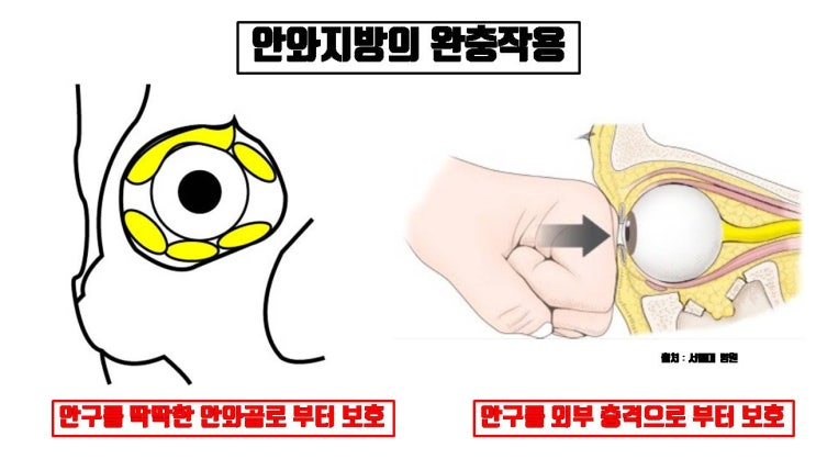  두꺼운 눈두덩이 개선하겠다고 안와지방 모두 제거하면 난리가 납니다.!!!