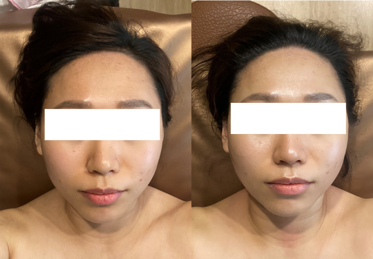  청주 율량동피부관리실 뷰티콜라겐 미백관리 했어요~
