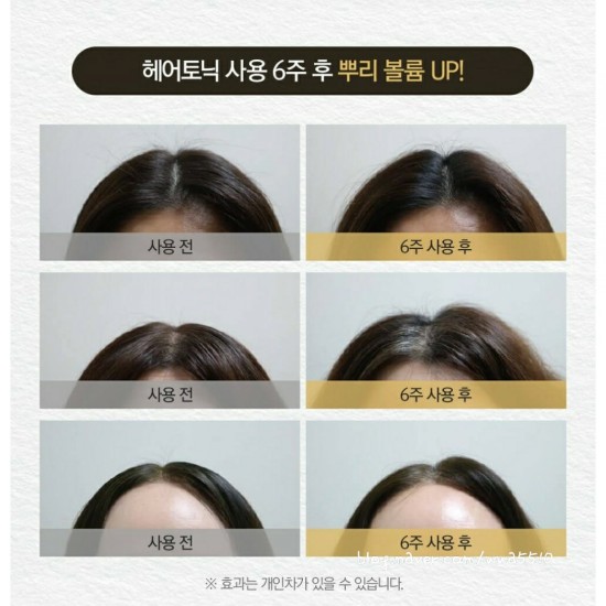  가르마 탈모 샴푸에 이어서 프리미엄 토탈 헤어 토닉