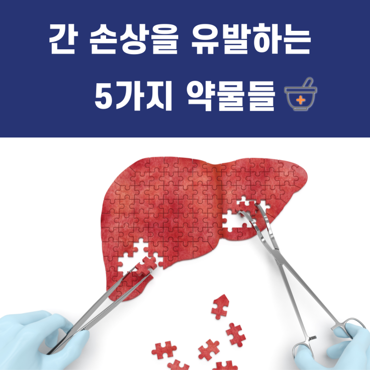  간 손상을 유발하는 5가지 약물