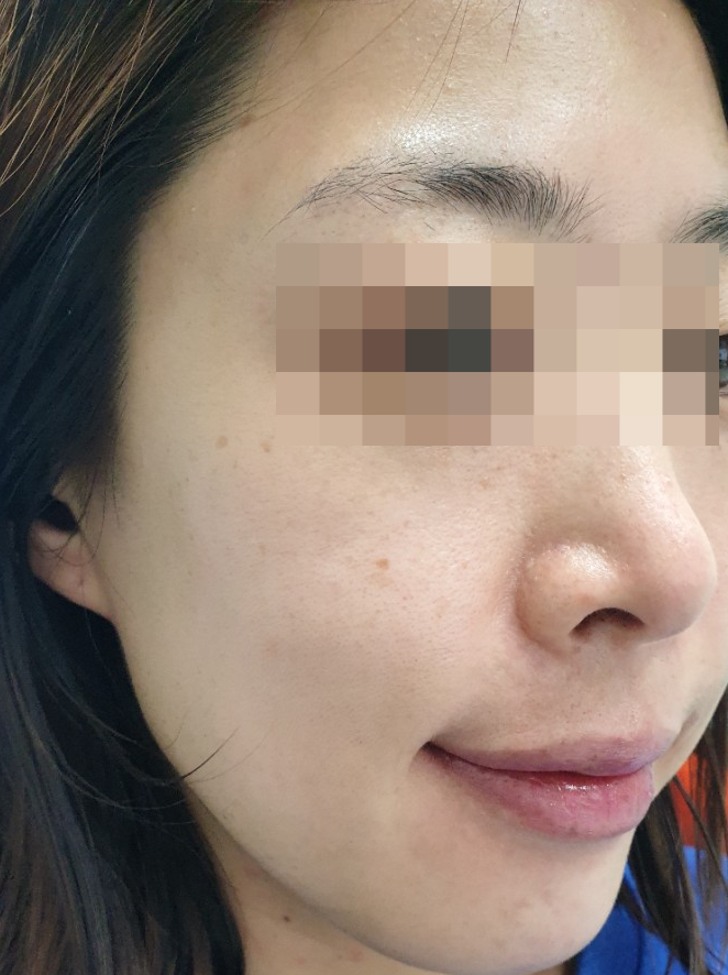  얼굴 속당김 해결법은 천연로션이예요