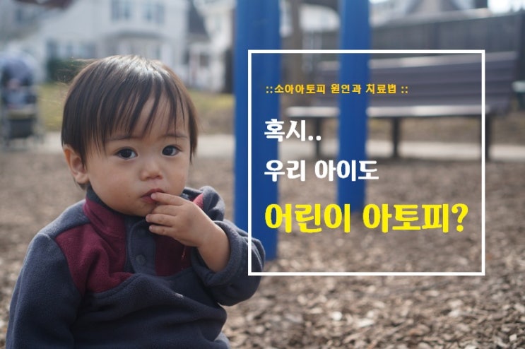  우리 아이도 어린이아토피? 소아아토피 원인과 치료법