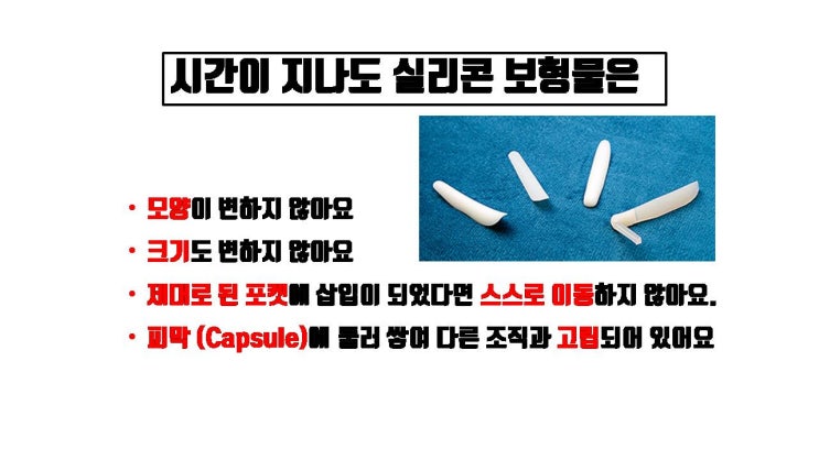  두 가지 경우를 제외하고 10년마다 코보형물 바꿀 필요 없어요.