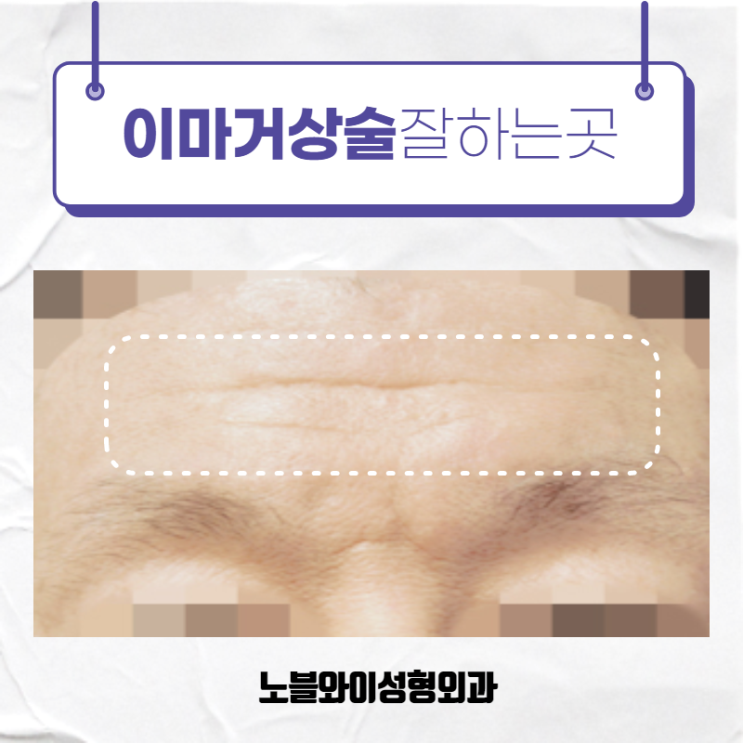  이마거상술잘하는곳 효과가 분명해