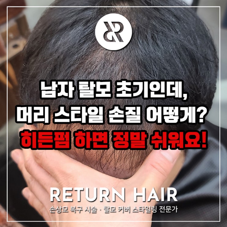  안양 박달동에서 남자 탈모 초기 증상으로 미용실에 방문하시어 탈모 히든펌으로 고민 해결!