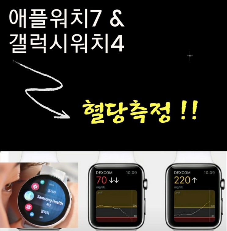  애플워치 7 세댸 & 갤럭시워치 4 바늘없는 혈당 측정 기능 제공되나?