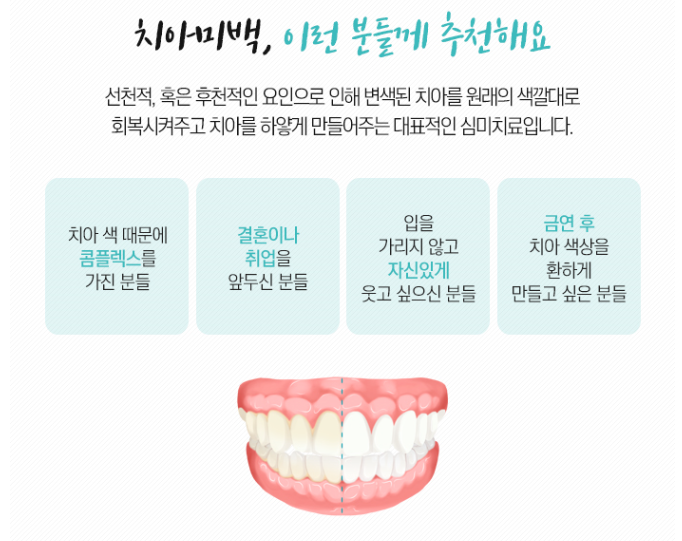 야탑역치과추천 착색된 치아미백으로 개선한 케이스 5