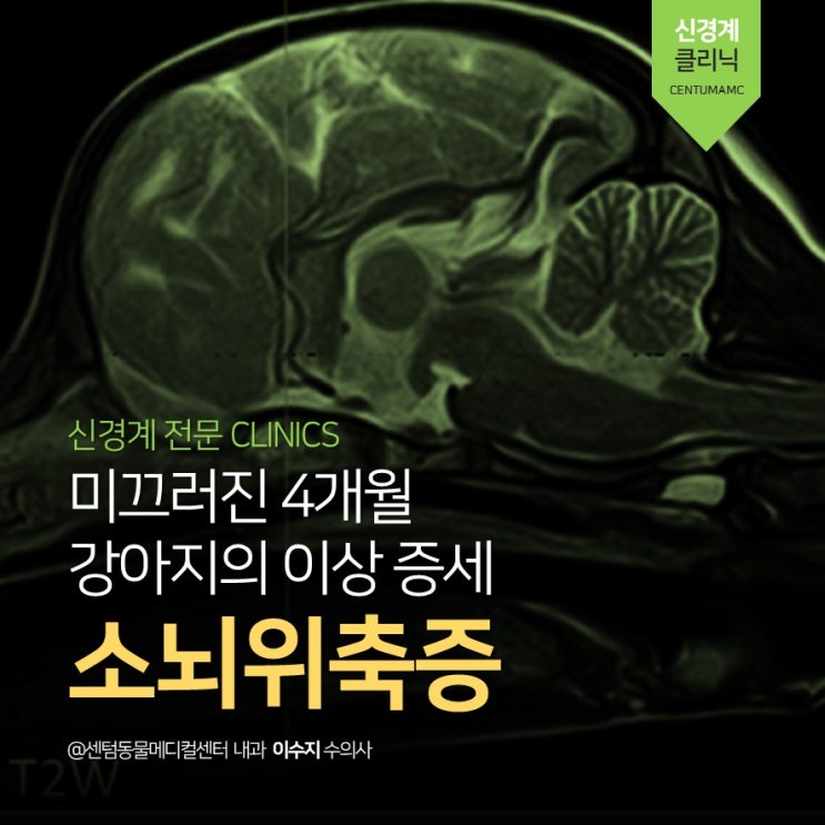 4개월 강아지 소뇌 위축증(cerebellar atrophy) (부산 뇌신경 전문 석박사 진료진 동물병원, MRI, 센텀동물메디컬센터)