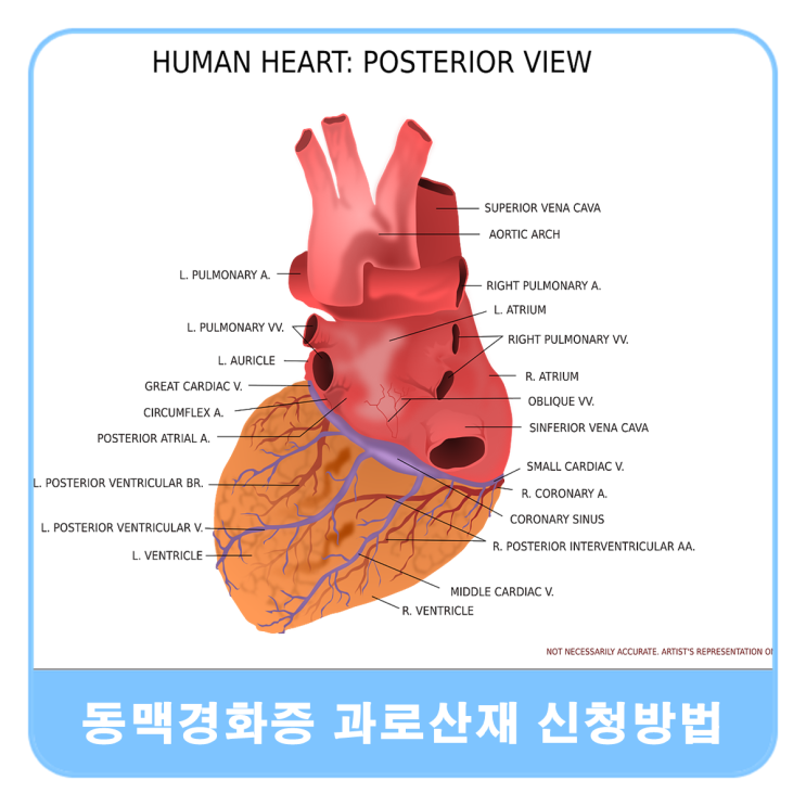  동맥경화증 과로산재 신청방법