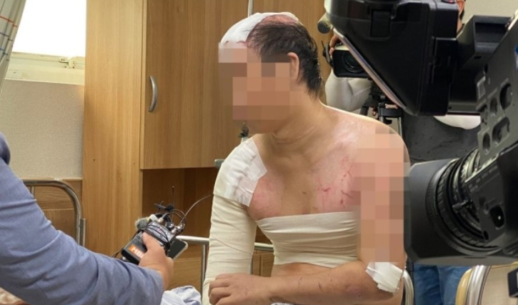 '지정장애 선배' 돈 못벌자 끓는 물 부으며 학대한 20대 연인 각각 15년 '지정장애 선배' 돈 못벌자 끓는 물 부으며 학대한 20대 연인 각각 15년