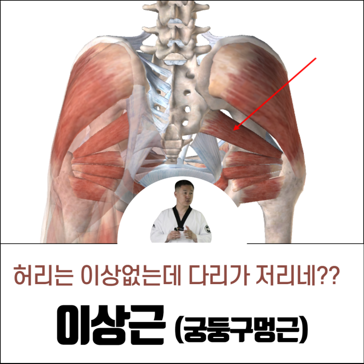  다리저림 이상근 증후군 운동 스트레칭 알아봅니다