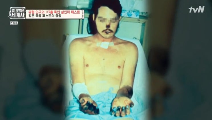  벌거벗은 세계사 4회-중세 유럽의 살인마 페스트를 통해 무엇을 배울 수 있는가?