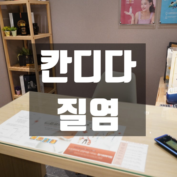  광명칸디다질염치료 참고만 있지 말고