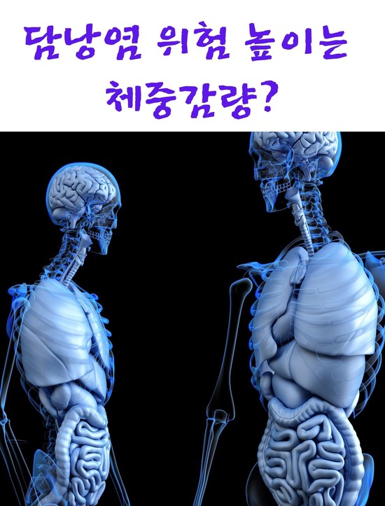  담낭염 위험 높이는 체중감량?