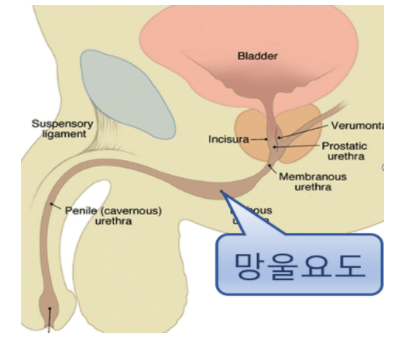 소변 후 잔뇨를 느끼면 3