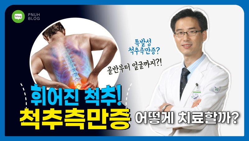 척추측만증, 휘어진 척추 어떻게 치료할까? / 부산대학교병원 정형외과 이정섭 교수